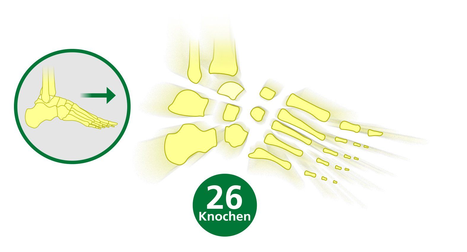 Diagram of foot bones showing 26 bones in yellow Illustration of human foot bones highlighting 26 bones with an inset showing foot structure