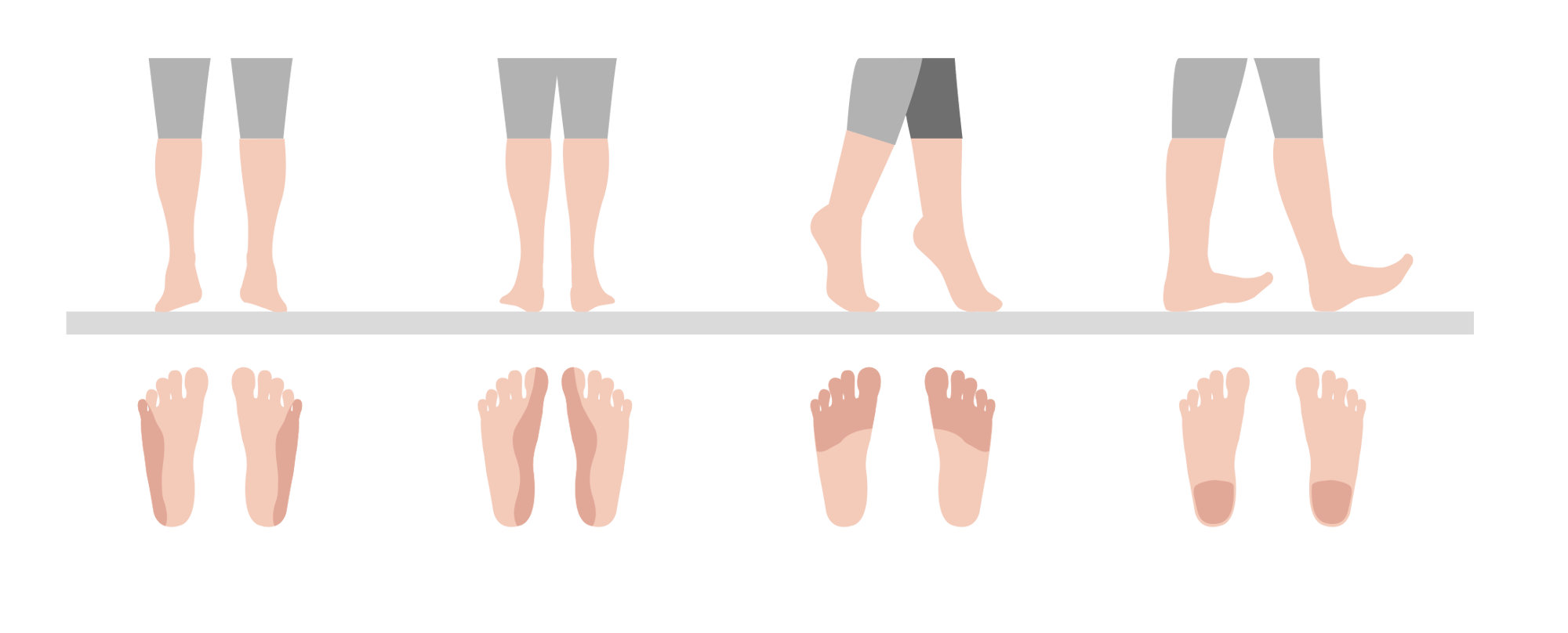 Grafik zur Darstellung verschiedener Fußstellungen beim Gehen Illustration von Füßen in unterschiedlichen Positionen, die den Gangzyklus beim Gehen veranschaulicht