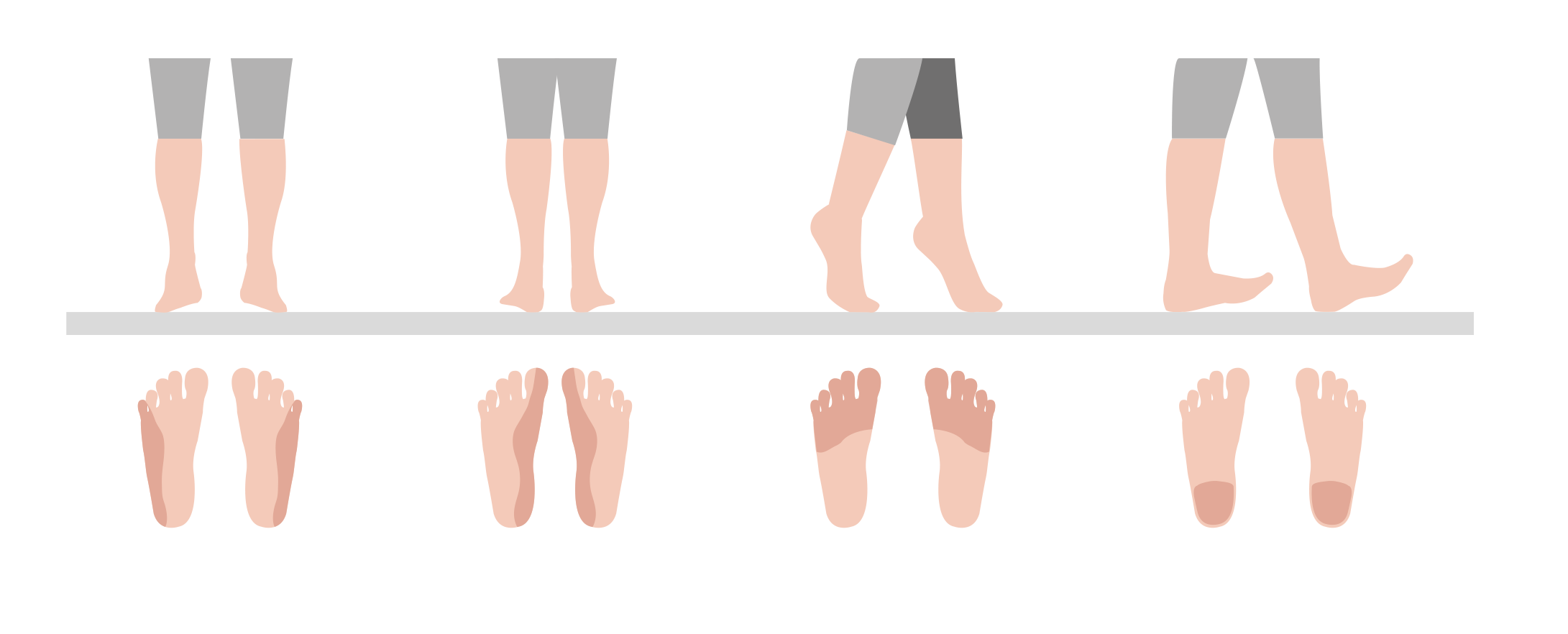 Illustration of various foot movements on flat and inclined surfaces Diagram showing different foot positions and movements, including standing on flat ground and inclined surfaces