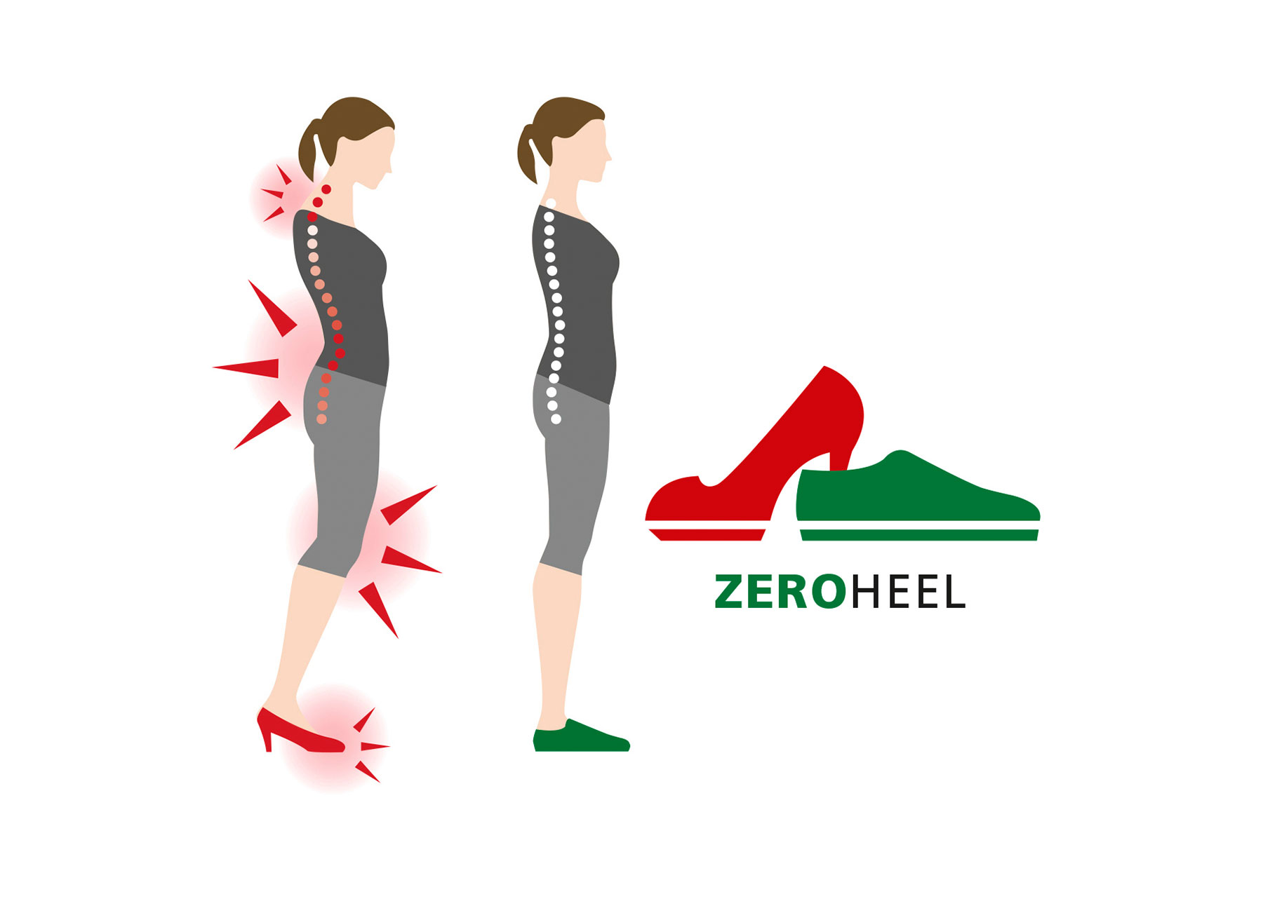 Illustration showing the posture impact of high heels versus Zero Heel shoes Comparison of a woman's posture in high heels versus Zero Heel shoes, highlighting improved alignment